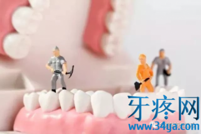 牙医洗牙会洗坏牙齿吗？