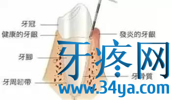 牙疼怎么办？史上最全立刻止疼小妙招！