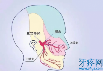 针刺治疗三叉神经痛的经验