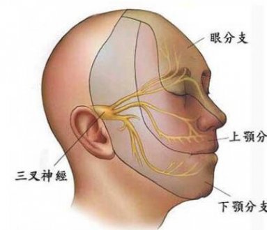 三叉神经痛与牙痛的区别是什么？