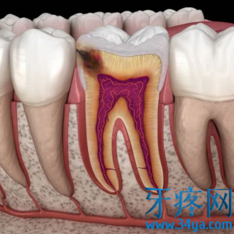 牙疼吃消炎药行不行？怎么治疗牙疼？