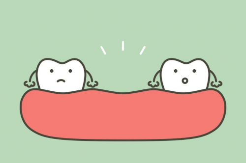 牙齿缺失都是什么原因造成的？