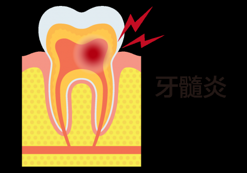 牙痛是什么原因导致的？