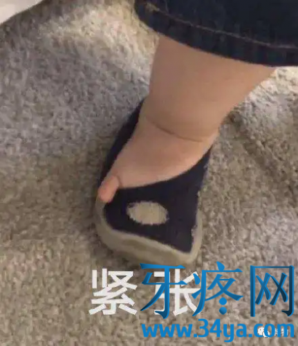 肚脐眼里的泥能抠吗？肚脐眼里面的脏东西可以清理吗?