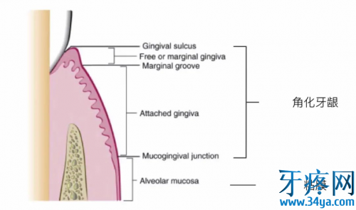 膜龈缺损的诊断分类