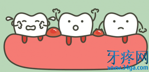 后槽牙牙龈肿痛怎么办？
